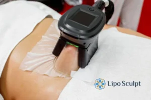 Cryolipolysis Helping You Getting that Perfect Summer Body 3 Cryolipolysis Milton Keynes can give you the best summer body - contact us today!