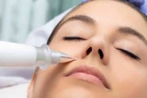 Best Actinic Keratoses Removal 3 Actinic keratoses Milton Keynes solutions - book in today!